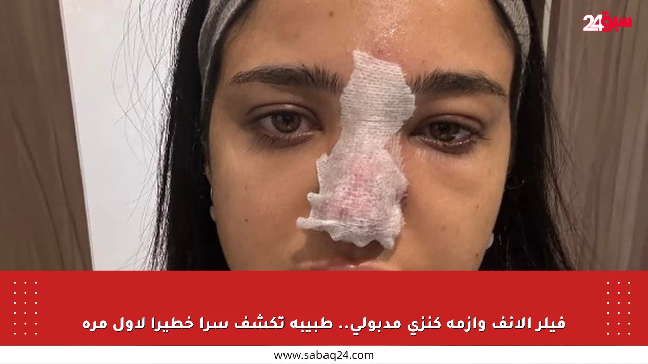 فيلر الأنف وأزمة كنزي مدبولي.. طبيبة تكشف سرا خطيرا لأول مرة